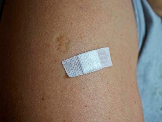 19 04 2021, Vaccinations in the Corona vaccination centre in Bad Wörishofen, a vaccinated patient has received his first vaccination in the upper arm A small plaster sticks on the injection site 19 04 2021, Vaccinations Covid 19 19 04 2021, Vaccinations Covid 19