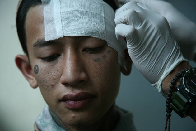 Bilder des Jahres 2021, News 04 April News Bilder des Tages Indonesia: Free tattoo removal on the holy month of Ramadan Gilang Fajar, 22 years old, already has his tattoo as following the trend for 3 years, being removed at the Baitul Muhyi Mosque in the East Jakarta Mayor s Office Complex, Friday (30 04 2021). The Islamic Medical Service (IMS) in collaboration with the National Zakat Agency (BAZNAS DKI) held a free tattoo removal roadshow for participants throughout the Special Capital Region of Jakarta. With the theme Ramadhan outlined Marginal with the overall target of participants in this activity, namely 550 participants, this activity is carried out in accordance with the Covid-19 health protocol, participants keep their distance and take the GeNose C19 test before the activity is carried o Copyright: KuncoroxWidyoxRumpoko