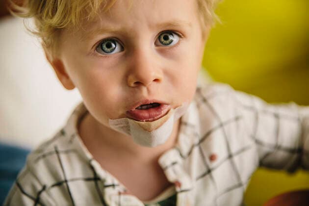 Portrait of little boy with patch on his chin model released Symbolfoto MFF04865