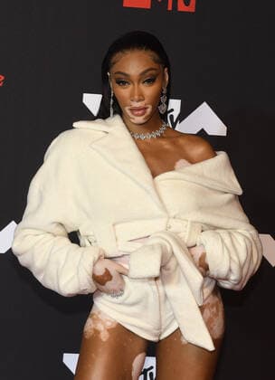 June 8, 2017, New York, NY, USA: Winnie Harlow attends the 2021 MTV Video Music Awards at Barclays Center on September 12, 2021 in the Brooklyn borough of New York City. New York USA - ZUMAs181 20170608_zea_s181_173 Copyright: xImagespacex