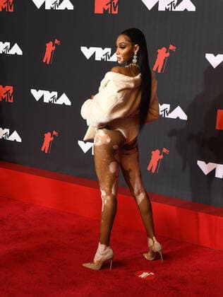 June 8, 2017, New York, NY, USA: Winnie Harlow attends the 2021 MTV Video Music Awards at Barclays Center on September 12, 2021 in the Brooklyn borough of New York City. New York USA - ZUMAs181 20170608_zea_s181_171 Copyright: xImagespacex
