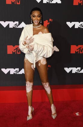 June 8, 2017, New York, NY, USA: Winnie Harlow attends the 2021 MTV Video Music Awards at Barclays Center on September 12, 2021 in the Brooklyn borough of New York City. New York USA - ZUMAs181 20170608_zea_s181_172 Copyright: xImagespacex