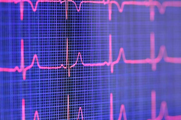 Tablet computer screen displaying an electrocardiogram, 31.07.2014, Copyright: xGIPhotoStockx blue,pink,close-up,differential focus,full frame,still life,studio shot,concepts,connections,information,precision,accuracy,well being,chart,human heart,indoors,communication,technology,computer monitor,digital tablet,measurement,nobody,medical,pulse trace,medicine,science,biology,monitoring,result,health,diagnosis,screen,analyzing,cardiology,healthcare,August 2014 Release,Analysing,Accuracy,Connection,Disciplines,Natural Science,Life Science,Biology,Health,Information,Precision,Wellbeing,Unwell,Illness,Blue,Pink,No People,Full Frame,Close-Up,Selective Focus,Human Heart,Computer,Computer Monitor,Portable Information Device,Digital Tablet,Medicin Ref:IS09AJ6BO