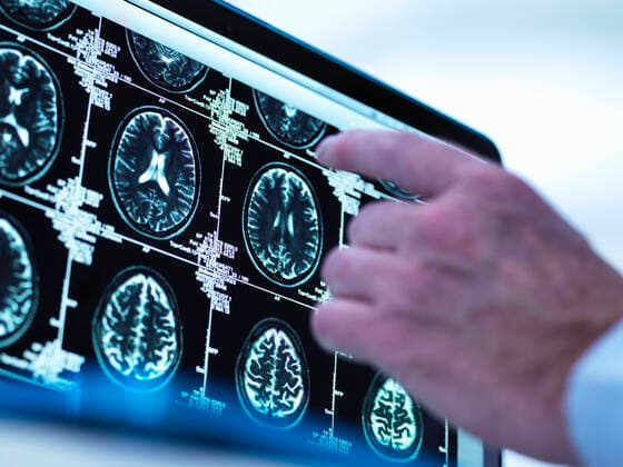 Doctor viewing a series of MRI (Magnetic Resonance Imaging) brain scans on a screen, 06.10.2015, Copyright: xAndrewxBrookesx, model released, focus on background,precision,accuracy,skill,well being,slice,brain,hand,one person,doctor,indoors,hospital,pointing,technology,medical,mri scan,biology,advancement,consulting,cross section,health,diagnosis,screen,analyzing,diagnostic medical tool,diagnostic,neurology,healthcare,brain scan,October 2015 Release,Pointing,Analysing,Healthcare Occupation,Physician,Accuracy,Advice,Disciplines,Natural Science,Life Science,Biology,Health,Precision,Skill,Wellbeing,Unwell,Illness,One Person,Part Of,Cross Section,Selective Focus,Focus On Background,Animal Body Part,Animal Internal Organ,Animal Brain,Animal L Ref:IS09AT97O