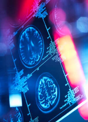 Human brain scan in a neurology clinic, 01.04.2016, Copyright: xAndrewxBrookesx , property released, cropped,digitally generated image,full frame,lens flare,low angle view,innovation,image,medical equipment,scientific equipment,brain,skull,indoors,disease,dementia,computer monitor,medical,medical examination,medical scan,mri scan,biology,clinic,diagnosis,radiology,analyzing,diagnostic medical tool,diagnostic,neurology,atrophy,alzheimer s disease,healthcare,graphical screen,neuroscience,neuroimaging,medical science,April 2016 Release,human brain,human head,Analysing,Disciplines,Natural Science,Life Science,Biology,Innovation,Mental Illness,Senile Dementia,Unwell,Illness,Part Of,Medical Procedure,Medical Examination,Full Frame,Digitally Gen Ref:IS09AW90O