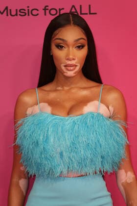 Winnie Harlow arrives at the MTV Europe Music Awards in Budapest, Hungary on Sunday, November 14, 2021.  HUN20211114031 SVENxHOOGERHUIS