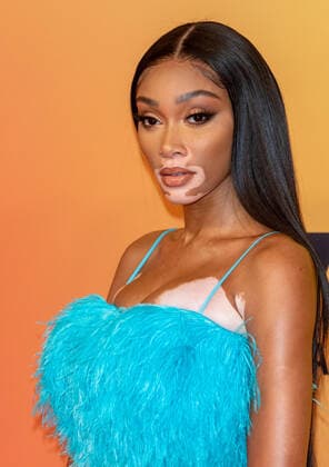 November 14, 2021, Budapest, Hungary: Winnie Harlow attends the 2021 MTV EMAs, Europe Music Awards, at Papp Laszlo Budapest Sports Arena in Budapest, Hungary, on 14 November 2021. Photo: Budapest Hungary - ZUMAm179 20211114_zep_m179_035 Copyright: xAlecxMichaelx
