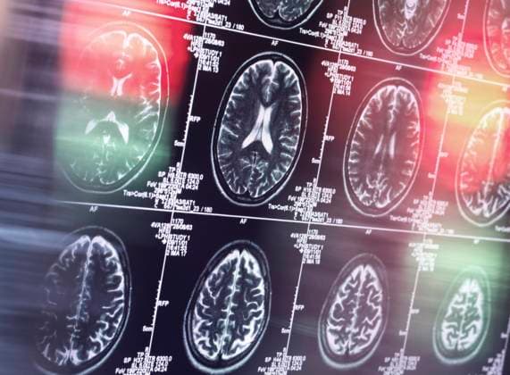 MRI scan of brain in clinic model released property released, ABRF00930