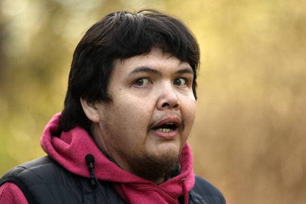 February 11, 2022, VICTORIA, BC, CANADA: Bear Henry is poses for a photo before a press conference at Beacon Hill Park in Victoria, Friday, Feb. 11, 2022. Henry went missing for 74 days while participating in the old-growth logging protests in Fairy Creek in the Cowichan Valley area near Port Renfrew. Henry was found by loggers in the area before returning home safely. VICTORIA CANADA  - ZUMAc35_ 20220211_zaf_c35_187 Copyright: xChadxHipolitox