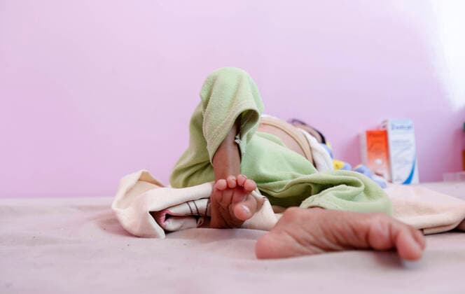 IMAGO Creative: Hunger (220314) -- SANAA, March 14, 2022 -- A malnourished child lies on a bed at the malnutrition treating ward in a hospital in Sanaa, Yemen, March 13, 2022. The United Nations Children s Fund (UNICEF) warned on Friday that millions of Yemeni people are at risk of famine as a result of the country s years-long military conflict and sharp deterioration of its economy, calling for urgent action. According to the UNICEF mission in Yemen, nearly 400,000 children under the age of five are slipping from acute malnutrition to severe acute malnutrition. TO GO WITH UN warns of impending famine in war-ravaged Yemen due to economic collapse (Photo by Xinhua) YEMEN-SANAA-CHILDREN-MALNUTRITION MohammedxMohammed 