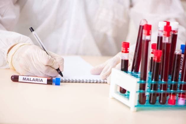 Young handsome lab assistant testing blood samples in hospital, model released, , property released, , 33319246.jpg, analyzing, biochemistry, biology, biotechnology, chemical, chemist, chemistry, doctor, lab, laboratory, medical, research, scientist, test, analysis, sample, health, examining, man, healthcare, medicine, virus, tubing, student, glass, diagnostic, researcher, bank, blood, checking, collecting, collection, donor, hematology, red, storage, hematologist, testing, aid, sign, microbes, bacteria, infection, malaria, writing, results, record, vaccine, antibiotic, tube,