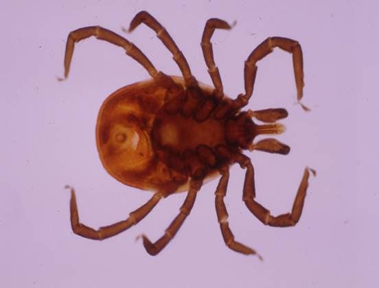 dangerous wooden tick, tick with legs and mouthparts, model released, , property released, , 33434786.jpg, Beine, Blutsauger, Chitin, Ektoparasiten, Exoskeleton, Exoskelett, Gefahr, Kleintiere, Krabbeltiere, Krankheiten, Makro, Mundwerkzeuge, Parasiten, Spinnentiere, Ticks, Ungeziefer, VergroÂ¶oÂüerung, Zecken, arachnids, bloodsuckers, braun, brown, crawl, crawlies, danger, diseases, ectoparasites, krabbeln, legs, macro, magnification, mouthparts, parasites, saugen, small animals, stechen, sting, suck, vermin