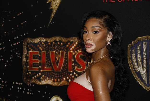 May 25, 2022, Cannes, France: Winnie Harlow attends the Elvis after party at Stephanie Beach during the 75th annual Cannes film festival on May 25, 2022 in Cannes, France. Cannes France - ZUMAs181 20220525_zea_s181_005 Copyright: xImagespacex