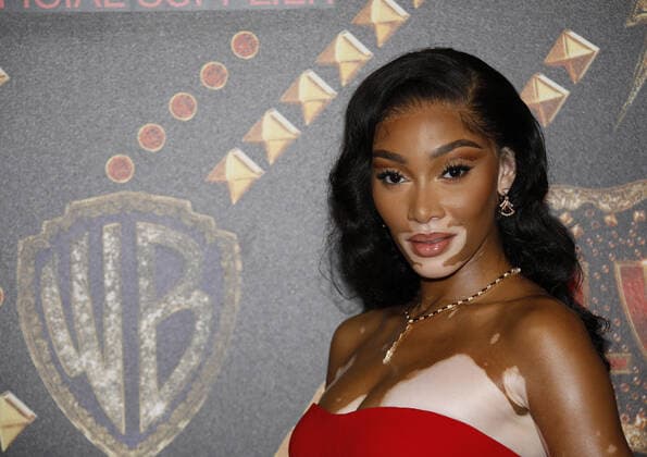 May 25, 2022, Cannes, France: Winnie Harlow attends the Elvis after party at Stephanie Beach during the 75th annual Cannes film festival on May 25, 2022 in Cannes, France. Cannes France - ZUMAs181 20220525_zea_s181_002 Copyright: xImagespacex