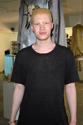 MBFW Vernissage of Shaun Ross and Nina Athanasiou Berlin Shaun Ross Albino Model AT The Vernissage of Shaun Ross and Nina Athanasiou Fashion Show during The Mercedes Benz Fashion Week in Berlin 06 07 2015