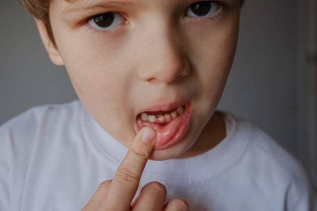 Creative Highlights Symbolbilder Closeup portrait of a kid showing his milk teeth, two rows Gomel, Gomel Region, Belarus R_PJWUOI230104-1100846-01 ,model released, Symbolfoto