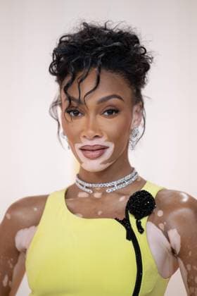 Winnie Harlow arrives on the red carpet of the 95th OscarsÂ® at the DolbyÂ® Theatre at Ovation Hollywood on Sunday, March 12, 2023.  Copyright: xx 34494-168PLX