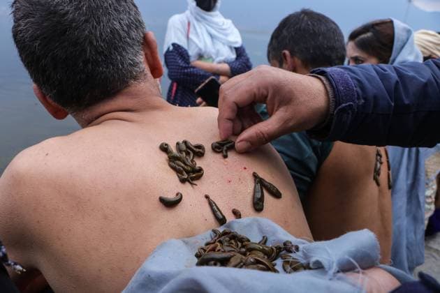 News Themen der Woche KW12 March 21, 2023, Srinagar, Jammu and Kashmir, India: A man receives leech treatment on his back on the bank of Dal Lake in Srinagar. Every year on Nowroz 21st March, traditional health workers in Kashmir use leeches to treat people who have itchy, painful lumps on their skin called chilblains that develop during the winter. Leech therapy is a long-practiced procedure in the Perso-Arabic traditional medicine of Unani, which is practiced in Muslim culture in South Asia as well as modern day Central Asia. Srinagar India - ZUMAa205 20230321_zip_a205_005 Copyright: xAdilxAbbasx