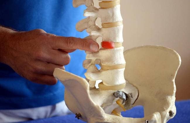 Bas Leeuwenberg ist einer von drei niederländischen Physiotherapeuten in Duisburg. Freitag den 17.10.2014. *** NUR FÜR REDAKTIONELLE ZWECKE *** EDITORIAL USE ONLY ***<p>Bas Leeuwenberg ist einer von drei niederländischen Physiotherapeuten in Duisburg. Freitag den 17.10.2014. Hier zeigt er anhand eines Modells einen Bandscheibenvorfall. Deutschland Nordrhein-Westfalen Duisburg Copyright: LarsxFröhlich *** Bas Leeuwenberg is a from Three Dutch Physiotherapists in Duisburg Friday the 17 10 2014 *** ONLY FOR EDITORIAL PURPOSE *** EDITORIAL USE ONLY *** P Bas Leeuwenberg is a from Three Dutch Physiotherapists in Duisburg Friday the 17 10 2014 here shows he using one Model a Slipped disc Germany North Rhine Westphalia Duisburg Copyright Lar Copyright: LarsxFröhlich docnrwhugopicture70654242 EDITORIAL USE ONLY