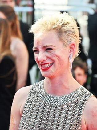 *Cannes, 77th Cannes Film Festival 2024, Fourth Evening - red carpet of the film Kinds of Kindness Cannes, 77th Cannes Film Festival 2024, Fourth Evening - red carpet of the film Kinds of Kindness - In the photo: Bebe Vio Cannes France  Copyright: xIPA ABACAx
