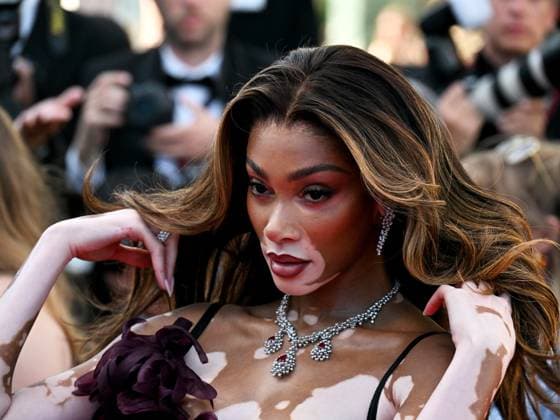 Cannes, 77th Cannes Film Festival 2024, Ninth Night. Red carpet of the film Le Comte de Monte-Cristo In the photo: Winnie Harlow  Copyright: xManuelexMangiarottix xipa-agencyx xPoolxPhotoxEventsx03x IPA_Agency_IPA46409175