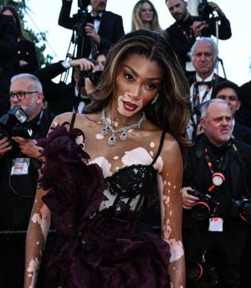Cannes, France: Cannes, 77th Cannes Film Festival 2024 Red Carpet of the film Le Compte de Monte-Cristo In the photo: Winnie Harlow Cannes France  - ZUMAp169 20240522_zea_p169_598 Copyright: xSimonexComi xipa-agency.netx