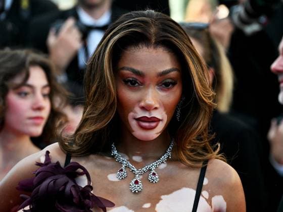 **Cannes, 77th Cannes Film Festival 2024, Ninth Night. Red carpet of the film Le Comte de Monte-Cristo - Cannes, 77th Cannes Film Festival 2024, Ninth Night. Red carpet of the film Le Comte de Monte-Cristo In the photo: Winnie Harlow Cannes France  Copyright: xIPA ABACAx