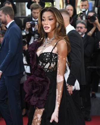 Cannes, France: Cannes, 77th Cannes Film Festival 2024, Red carpet film The Count of Monte Cristo In the photo: Winnie Harlow Cannes France  - ZUMAp169 20240522_zea_p169_789 Copyright: xAlbertoxTerenghix