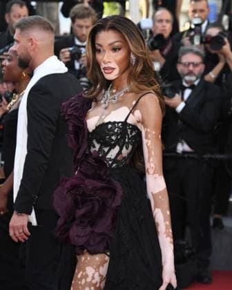 Cannes, France: Cannes, 77th Cannes Film Festival 2024, Red carpet film The Count of Monte Cristo In the photo: Winnie Harlow Cannes France  - ZUMAp169 20240522_zea_p169_790 Copyright: xAlbertoxTerenghix