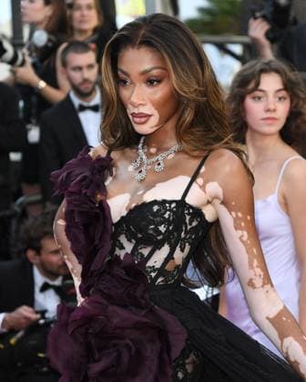 Cannes, France: Cannes, 77th Cannes Film Festival 2024, Red carpet film The Count of Monte Cristo In the photo: Winnie Harlow Cannes France  - ZUMAp169 20240522_zea_p169_793 Copyright: xAlbertoxTerenghix