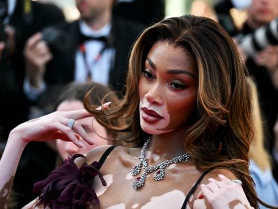 Entertainment Bilder des Tages Cannes, France: Cannes, 77th Cannes Film Festival 2024, Ninth Night. Red carpet of the film Ã¢â‚¬oeLe Comte de Monte-CristoÃ¢â‚¬Â In the photo: Winnie Harlow Cannes France  - ZUMAp169 20240522_zea_p169_795 Copyright: xManuelexMangiarottix