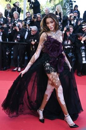 Cannes Le Comte de Monte-Cristo Premiere AM Winnie Harlow attending the Le Comte de Monte-Cristo Premiere as part of the 77th Cannes International Film Festival in Cannes, France on May 22, 2024. Photo by Aurore Marechal ABACAPRESS.COM Cannes France  Copyright: xMarechalxAurore ABACAx