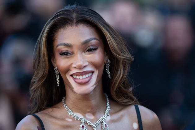 Cannes Le Comte de Monte-Cristo Premiere AM Winnie Harlow attending the Le Comte de Monte-Cristo Premiere as part of the 77th Cannes International Film Festival in Cannes, France on May 22, 2024. Photo by Aurore Marechal ABACAPRESS.COM Cannes France  Copyright: xMarechalxAurore ABACAx