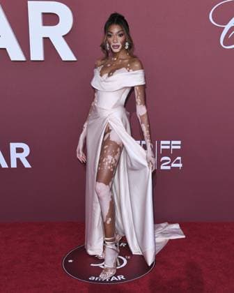 Cap d Antibes, 30th amfAR gala Cannes In the photo: Winnie Harlow  Copyright: xAlbertoxTerenghix xipa-agency.nex xPoolxPhotoxEventsx03x IPA_Agency_IPA46454446