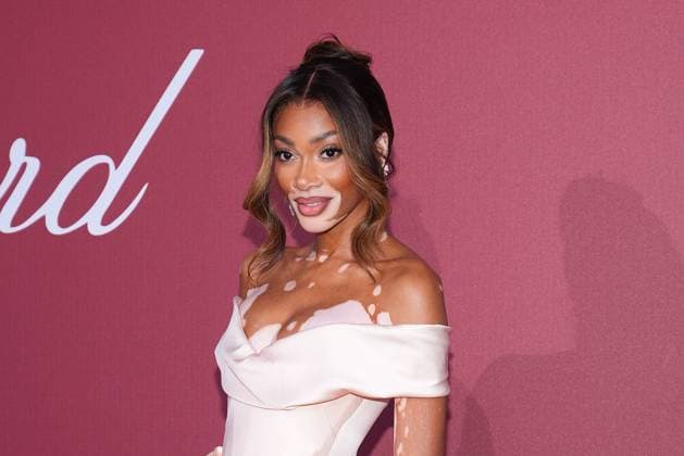 Winnie Harlow at the Amfar Gala on 23 05 2024 as part of the 77 Film Festival in Cannes Cannes Film Festival 2024 Amfar Gala