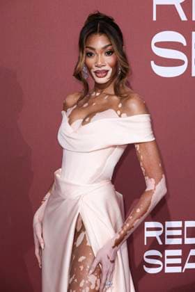 Cannes - amfAR Gala Winnie Harlow attends the amfAR Cannes Gala 30th edition presented by Chopard and Red Sea International Film Festival at Hotel du Cap-Eden-Roc on May 23, 2024 in Cap d Antibes, France. Photo by Marco Piovanotto ABACAPRESS.COM Cap d Antibes France  Copyright: xPiovanottoxMarco ABACAx