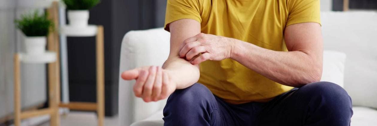 Human man scratching skin due, Human man scratching skin due to itchy psoriasis, Human man scratching skin due to itchy psoriasis model released, Symbolfoto , 13.04.2024, Copyright: xAndreyPopovx Panthermedia37085932.jpg