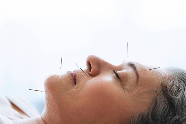 Creative Highlights Symbolbilder Senior patient with acupuncture needle over face lying on massage table model released, Symbolfoto property released, AAZF02057