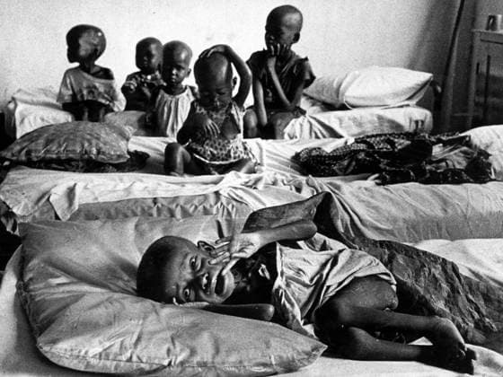 Biafra 1969-03-15 Hungersnöd i Biafra i samband med Biafrakriget. Undernärda barn. Biafra Nigeria x53x *** Biafra 1969 03 15 Famine in Biafra during the Biafran war Malnourished children Biafra Nigeria x53x  Copyright: xSven-ErikxSjöberg DN TTx HUNGERSNÖD BIAFRA