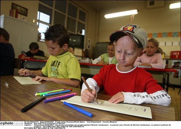 Ass HLN: First schoolday of Michiel Diepenbeek 03 09 2007 - De eerste schooldag van progeriapatient Michiel Vandeweert - le premier jour d ?cole de Michiel Vandeweert, un patient souffrant de progeria Diepenbeek Belgium  Copyright: xJohanxEyckensx