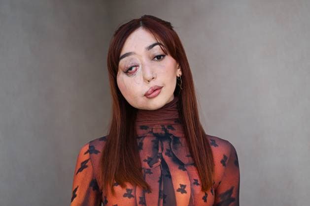 PFW Acne Studios Photocall Nikki Lilly attending the Acne Studios Womenswear Spring Summer 2026 show as part of Paris Fashion Week in Paris, France on October 01, 2025. Photo by Aurore Marechal ABACAPRESS.COM Paris France  Copyright: xMarechalxAurore ABACAx