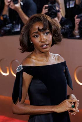 January 11, 2026, Beverly Hills, California, USA: Ayo Edebiri on the red carpet at the 83rd Annual Golden Globe Awards on Sunday, January 11, 2026, at the Beverly Hilton in Beverly Hills, California. BURT HARRIS BNS PI Beverly Hills USA - ZUMAp124 20260111_zaa_p124_275 Copyright: xBurtxHarrisx