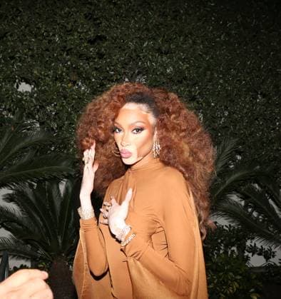 Pre-GRAMMY Gala & GRAMMY Salute to Industry Icons Honoring Avery Lipman and Monte Lipman Winnie Harlow at the 68th GRAMMY Awards Pre-GRAMMY Gala & GRAMMY Salute to Industry Icons Honoring Avery Lipman and Monte Lipman at The Beverly Hilton, Los Angeles, USA, 31 January 2026., Credit:MHD Avalon  Copyright: xMHDx xAvalonx 1071176052