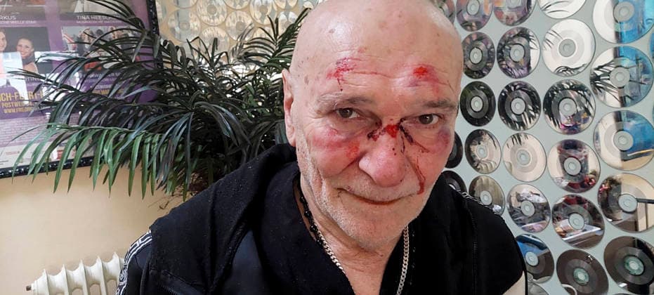 Picture may be published with the permission of Peter Sebastian German pop singer Peter Sebastian is robbed in his office, threatened with a knife and beaten with severe facial injuries The perpetrator flees the police investigates HH Germany