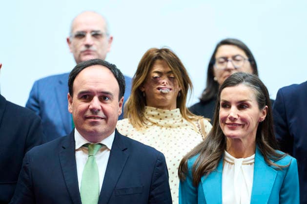 03-03-2026 Plana Queen Letizia at the event to mark World Day for Rare Diseases, at the Palacio de Congresos de Castellon, in Castellon de la Plana, Valencian Community. No Spain Â  Copyright: xPPEx