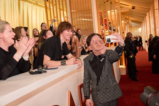 Adam Pearson arrives on the red carpet of the 98th OscarsÂ® at the DolbyÂ® Theatre at Ovation Hollywood on Sunday, March 15, 2026. Los Angeles CA USA  35008876PLX