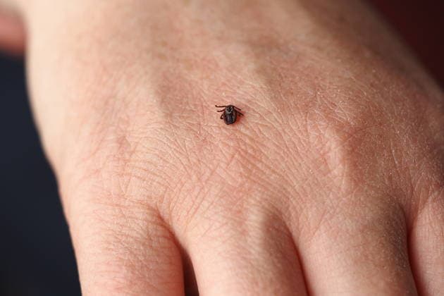 Ixodide, encephalitische Live-Zick auf dem menschlichen Körper Nahaufnahme, Makrofotografie. Ixodid, encephalitic live tick on the human body close-up, macro photography. High quality photo (License=RF) Copyright: xZoonar.com ?????x??????x 18600854