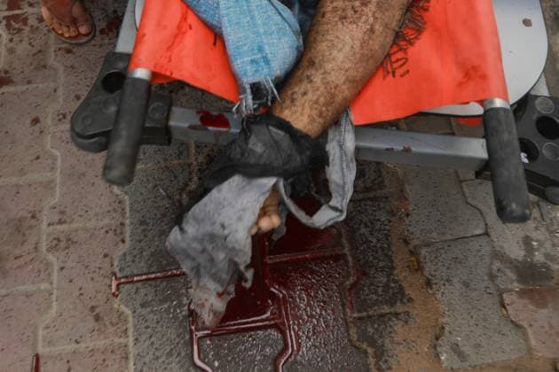 News Bilder des Tages RECORD DATE NOT STATED Palestinian Israel conflit (INT) PALESTINIAN-ISRAEL-CONFLICTMay 9, 2026, Gaza, Palestine: Hospital workers lift the body of 57-year-old Eyad al-Matouq as it lies on a gurney at the Gaza City al-Shifa Hospital, after he was killed when he was reportedly targeted by an Israeli reconnaissance aircraft while riding an electric bicycle in the Jabalia refugee camp in the northern Gaza Strip on May 9, 2026, The war was sparked by Hamas s October 7, 2023 attack on Israel, which resulted in the deaths of 1,221 people. Israel s retaliatory assault on Gaza has killed at least 72,736 people, according to figures from the health ministry that the UN considers reliable. Credit: Hashem Zimmo Thenews2(Foto: Hashem Zimmo Thenews2 imago images) Palestinian  Copyright: xHashemxZimmox
