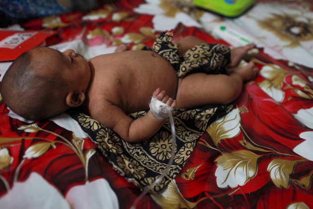 May 21, 2026, Dhaka, Dhaka, Bangladesh: Children suffering from measles receive treatment at a hospital in Dhaka, Bangladesh, on May 21, 2026, as the country faces a growing outbreak. Dhaka Bangladesh - ZUMAj163 20260521_zip_j163_009 Copyright: xAbuxSufianxJewelx