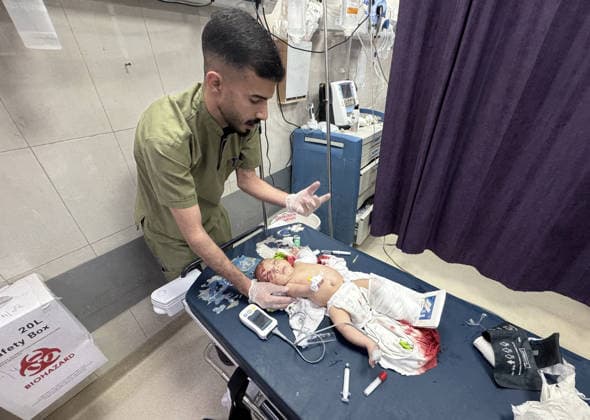 Israeli attacks on Gaza continue despite ceasefire agreement KHAN YUNIS, GAZAI PALESTINE - MAY 25: (EDITOR S NOTE: Image depicts graphic content) A Palestinian baby is taken to Nasser Hospital for medical treatment following the Israeli attack on tents housing displaced people in the al-Mawasi area despite the ceasefire agreement in Khan Yunis, Gaza, Palestine on May 25, 2026. A six-year-old child and a woman were killed and 20 people, most of them children and women, were injured in an attack. Abdallah F.s. Alattar Anadolu Khan Yunis Gaza. Editorial use only. Please get in touch for any other usage.  Copyright: x2026xAnadoluxAbdallahxF.s.xAlattarx